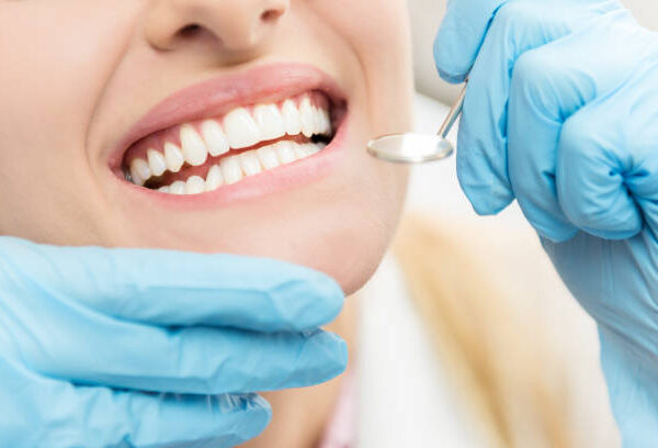 teeth whitening sydney